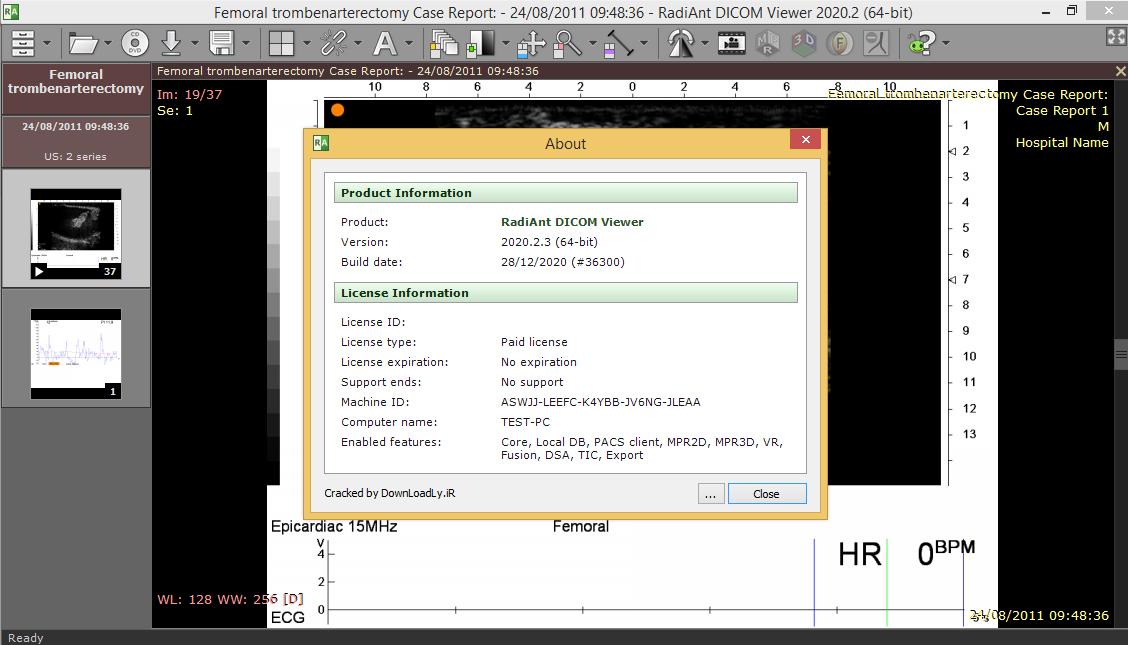 Radiant dicom viewer crack. Radiant программа. Radiant Dicom viewer ключ. Vidar Dicom viewer. Radiant Dicom.